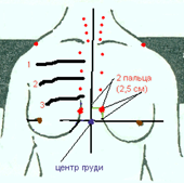 точковий масаж грудей